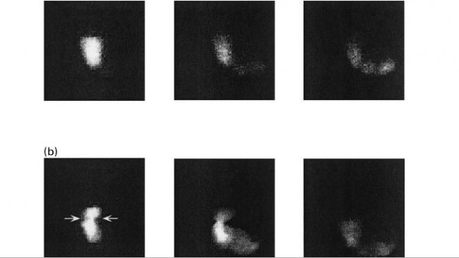 <p>Figure 1. Images of gastric emptying in pigs fed a diet based on starch (a), beet pulp (b) and wheat bran at 10, 60 and 120 minutes post-ingestion (Source: Guerin et al., 2001 ).</p>
